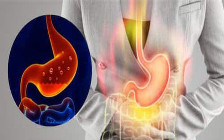 6 biện pháp tại nhà khắc phục chứng trào ngược axit dạ dày vào buổi sáng