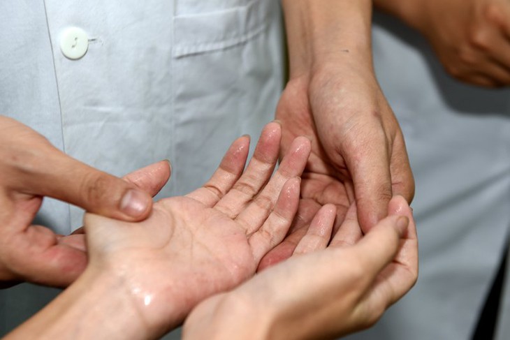 Ra mồ hôi tay nhiều phải làm sao?- Ảnh 1. Ra mồ hôi tay nhiều phải làm sao?- Ảnh 1.