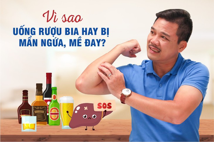 Vì sao uống rượu bia hay bị mẩn ngứa, mề đay? - Ảnh 1.