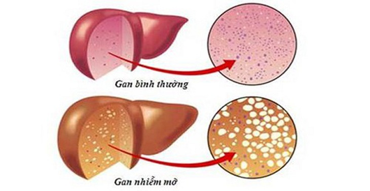 Chế độ ăn Địa Trung Hải tốt cho bệnh nhân gan nhiễm mỡ - Ảnh 1. Chế độ ăn Địa Trung Hải tốt cho bệnh nhân gan nhiễm mỡ - Ảnh 1.