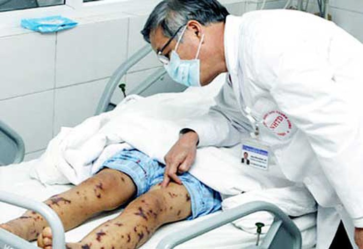 Bộ Y tế đề xuất 8 bệnh truyền nhiễm nhóm B nào ưu tiên bố trí ngân sách khám, chữa bệnh?- Ảnh 1. Bộ Y tế đề xuất 8 bệnh truyền nhiễm nhóm B nào ưu tiên bố trí ngân sách khám, chữa bệnh?- Ảnh 1.