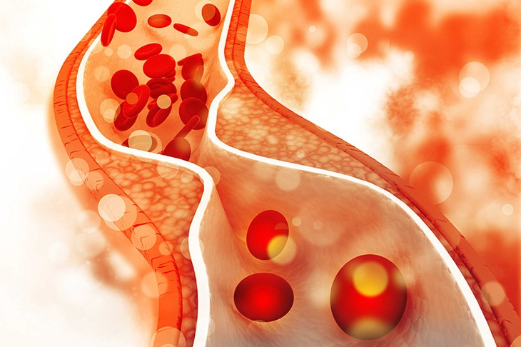 Thử nghiệm thuốc làm giảm cholesterol hiệu quả - Ảnh 1.