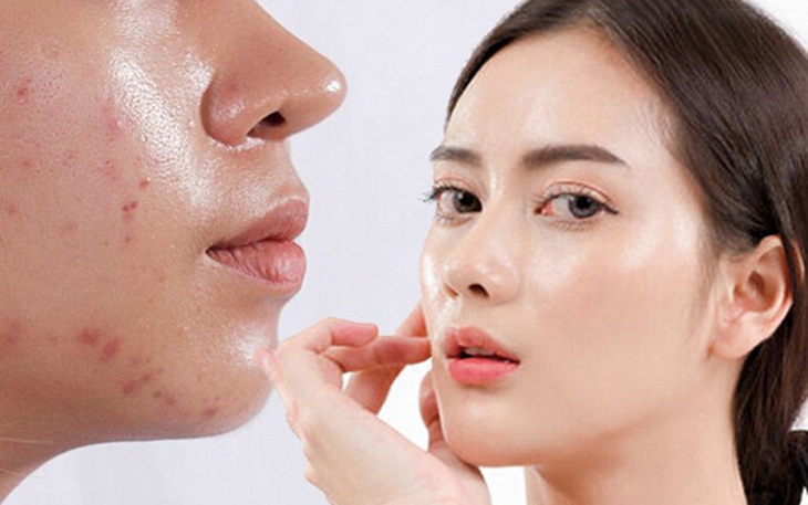 5 cách chăm sóc da với hoạt chất phù hợp - Ảnh 1.