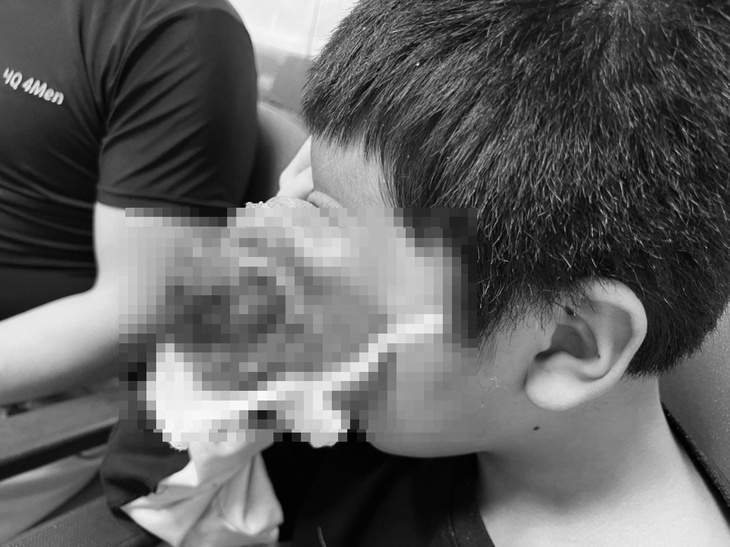 Xót xa bé trai 4 tuổi u 'quái' tại hốc mắt, khóc lả trong vòng tay bố - Ảnh 1. Xót xa bé trai 4 tuổi u 'quái' tại hốc mắt, khóc lả trong vòng tay bố - Ảnh 1.