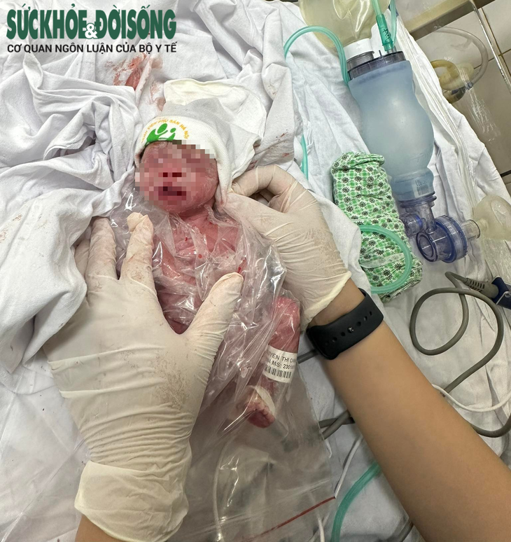 Bé sơ sinh chỉ nặng 800g do mẹ bị tiền sản giật nặng phải sinh non ở tuần 30 - Ảnh 3. Bé sơ sinh chỉ nặng 800g do mẹ bị tiền sản giật nặng phải sinh non ở tuần 30 - Ảnh 3.