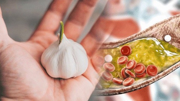 Chế độ ăn uống giúp giảm mỡ máu bạn cần biết để hạn chế nguy cơ đột quỵ - Ảnh 7.