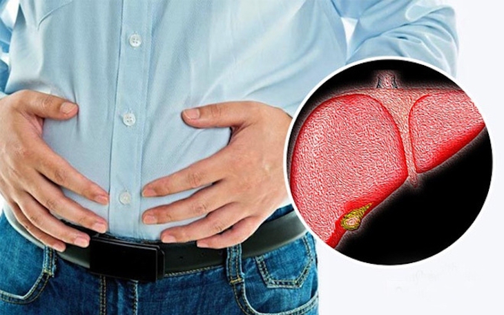 Gan nhiễm mỡ gây nên các bệnh gì?