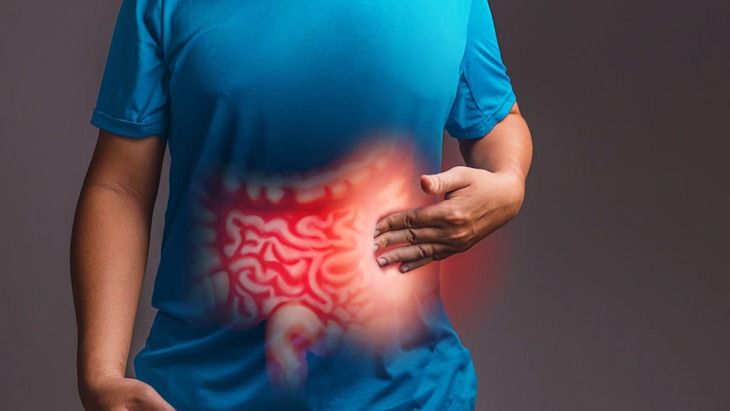 Vai trò của thuốc chống trầm cảm trong điều trị hội chứng ruột kích thích - Ảnh 1. Vai trò của thuốc chống trầm cảm trong điều trị hội chứng ruột kích thích - Ảnh 1.