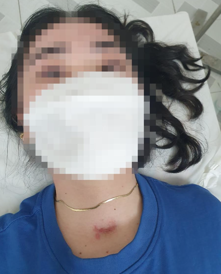 Cứu sống cô gái 17 tuổi mang khối u khí quản hiếm gặp - Ảnh 2.