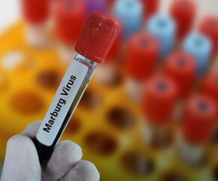 TP.HCM nâng cao cảnh giác với bệnh do virus Marburg - Ảnh 1.