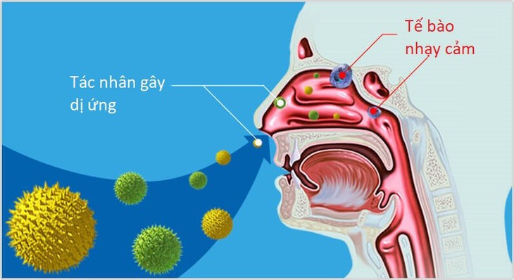 Hai bài thuốc trị viêm mũi dị ứng hiệu quả - Ảnh 1.