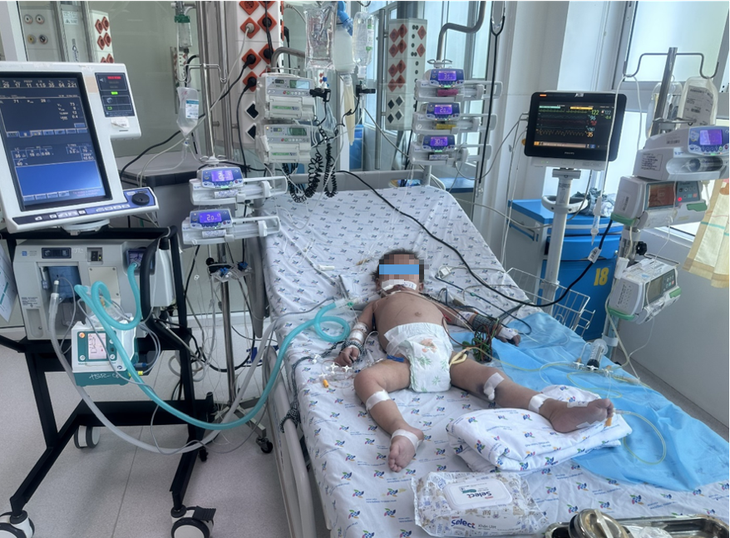 Bé 2 tuổi suýt chết do sốc sốt xuất huyết trên nền bệnh tim bẩm sinh - Ảnh 1.