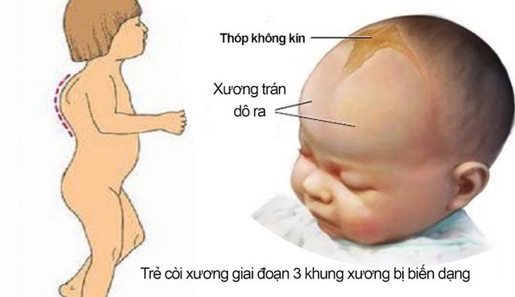 Chất dinh dưỡng đặc biệt nào giúp trẻ cao lớn và khỏe mạnh? - Ảnh 2.