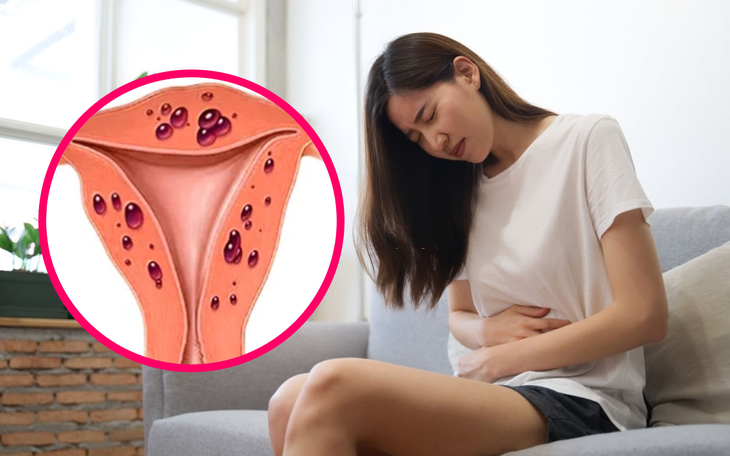 4 loại thực phẩm giúp kiểm soát cơn đau do lạc nội mạc tử cung