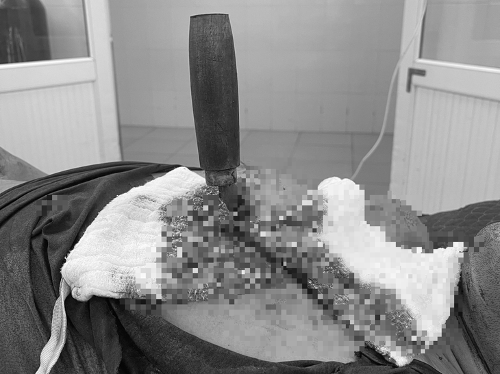 Hải Phòng: Báo động đỏ toàn viện, cứu sống ca bệnh với vết thương phức tạp vùng tim - Ảnh 1. Hải Phòng: Báo động đỏ toàn viện, cứu sống ca bệnh với vết thương phức tạp vùng tim - Ảnh 1.