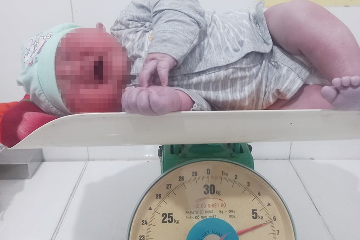Bé sơ sinh nặng 6kg chào đời - Ảnh 1. Bé sơ sinh nặng 6kg chào đời - Ảnh 1.
