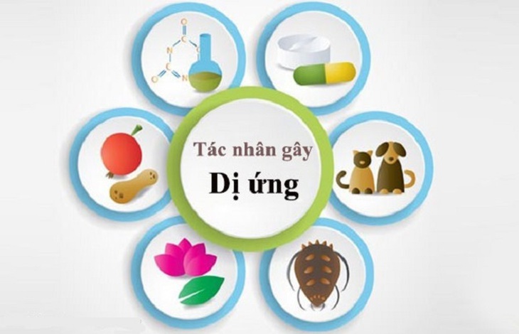 Điều trị viêm mũi dị ứng ở trẻ em - Ảnh 1.