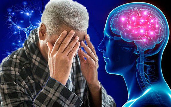 Vitamin D có thể giúp giảm nguy cơ sa sút trí tuệ