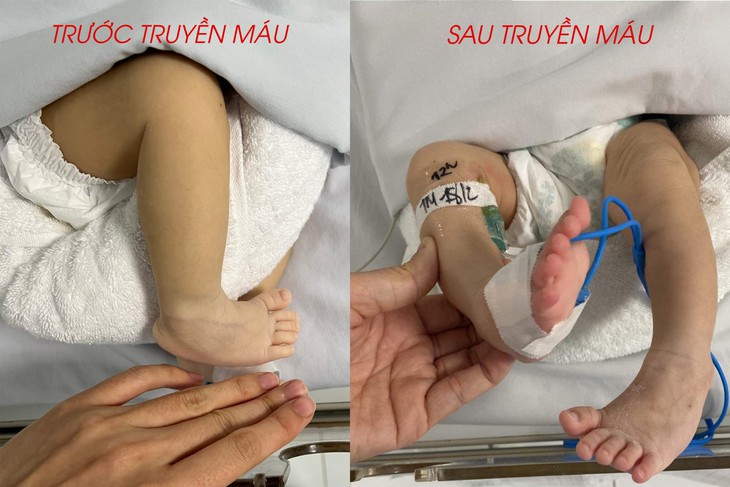 Bé sơ sinh có kháng thể trong máu chống lại các kháng nguyên phổ biến - Ảnh 4.