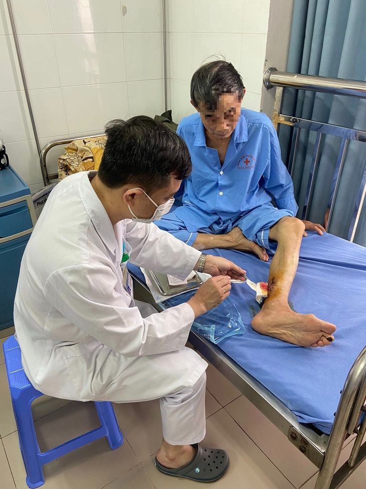 Cụ ông bị máy cưa cắt vào chân, máu phun thành tia - Ảnh 1.