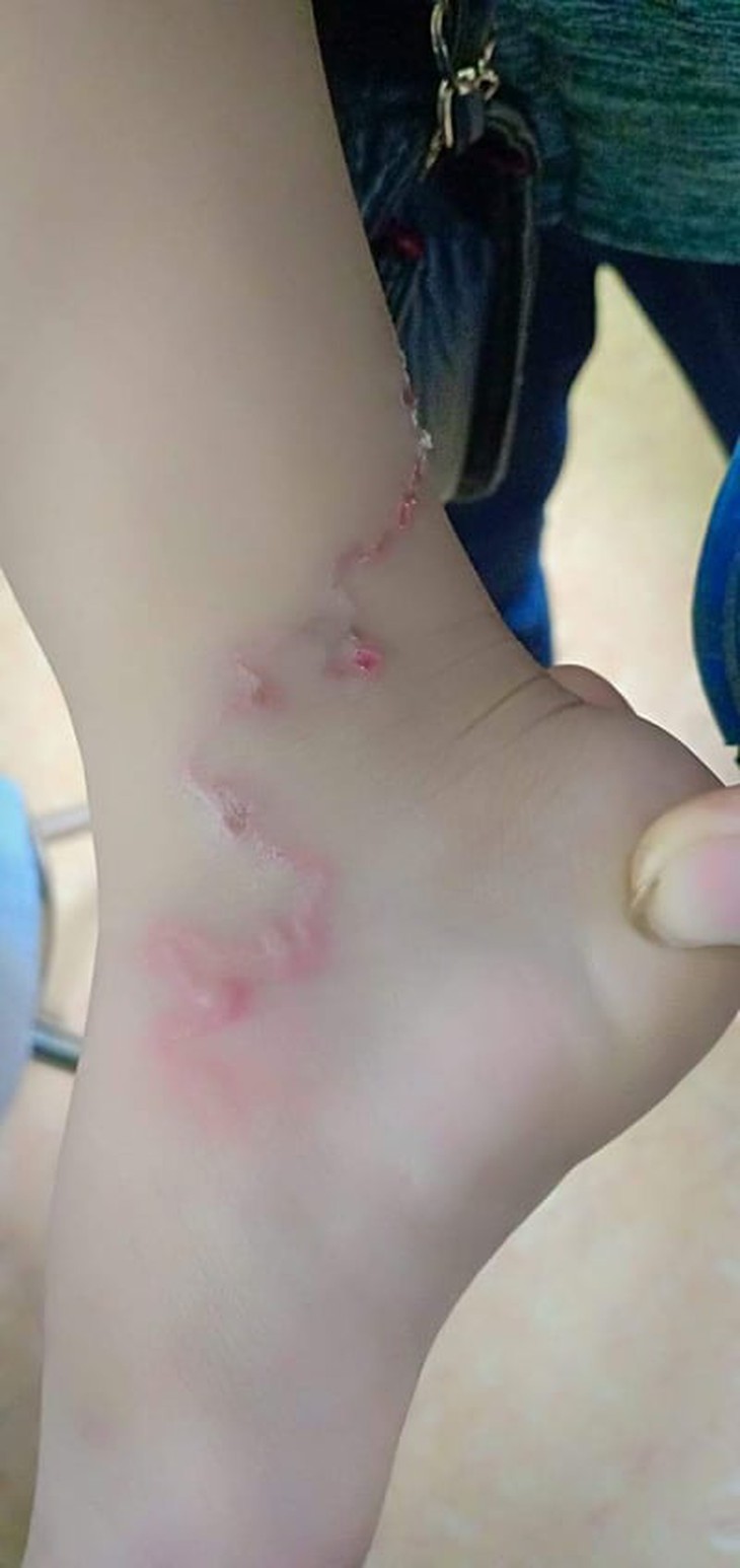 Tỷ lệ người dân nhiễm ký sinh trùng cao, Nghệ An đẩy mạnh công tác phòng, chống - Ảnh 2. Tỷ lệ người dân nhiễm ký sinh trùng cao, Nghệ An đẩy mạnh công tác phòng, chống - Ảnh 2.