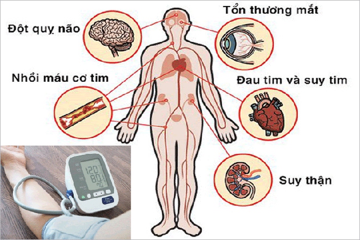 Những thực phẩm tự nhiên giúp hạ huyết áp an toàn - Ảnh 2.