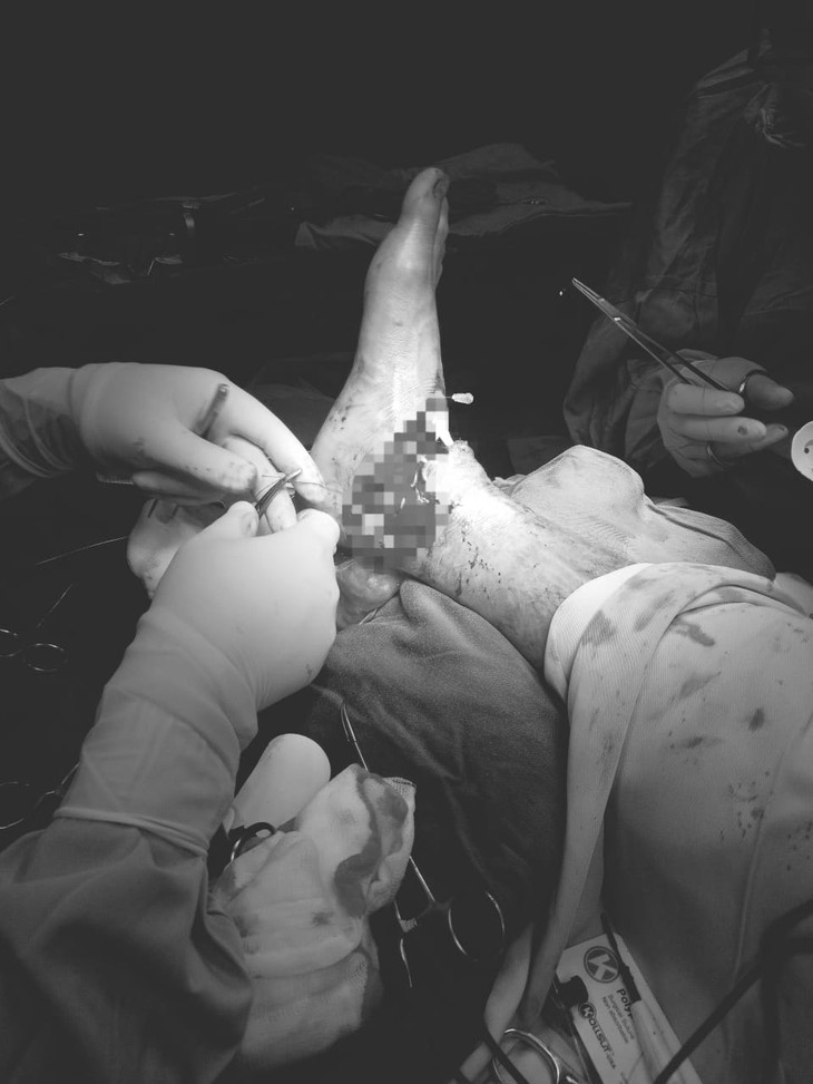 Người đàn ông gần đứt lìa bàn chân vì máy cắt cỏ - Ảnh 2.