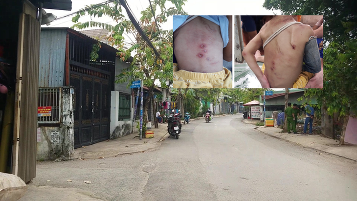 Vụ bé trai Hóc Môn chi chít vết thương: Xem xét cho nạn nhân tách khỏi cha mẹ - Ảnh 2. Vụ bé trai Hóc Môn chi chít vết thương: Xem xét cho nạn nhân tách khỏi cha mẹ - Ảnh 2.