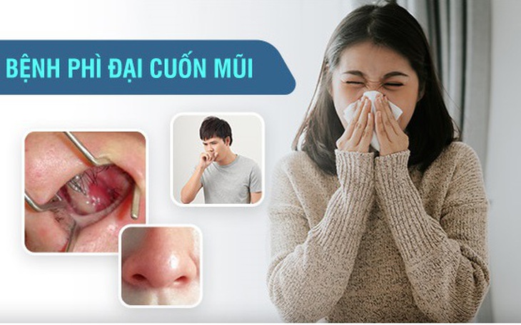 Ngạt mũi liên tục gây khó thở, khó ngủ: nguyên nhân và cách điều trị