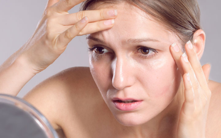 Cách khắc phục nếp nhăn trên trán