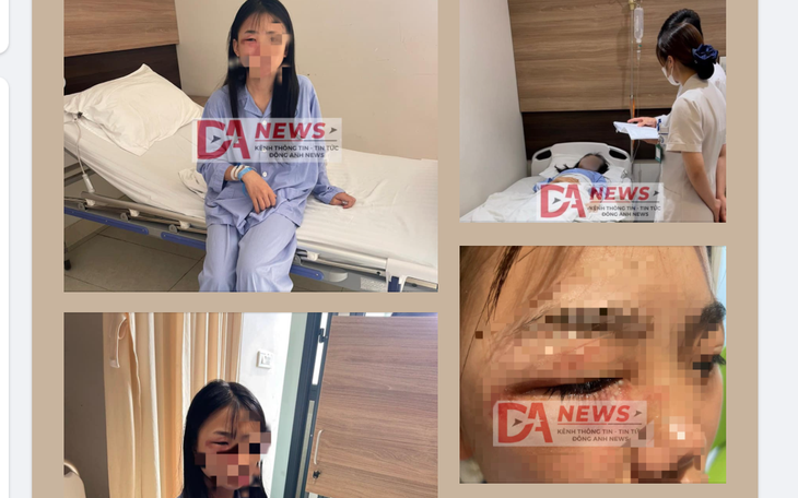 Nữ sinh lớp 8 ở Hà Nội nghi bị đánh hội đồng đến nhập viện