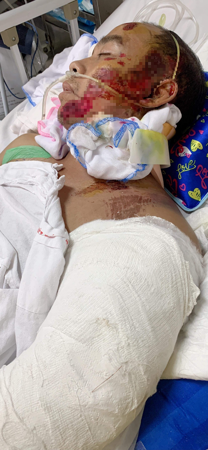MS 840: Éo le gia cảnh người đàn ông bị cuốn vào máy trộn bê tông - Ảnh 2.