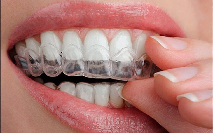 Thói quen xấu làm hại men răng thường gặp - Ảnh 1.