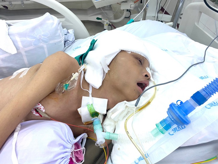 MS 841: Xót thương hoàn cảnh nam sinh nghèo bị chấn thương sọ não nặng sau tai nạn giao thông - Ảnh 1. MS 841: Xót thương hoàn cảnh nam sinh nghèo bị chấn thương sọ não nặng sau tai nạn giao thông - Ảnh 1.