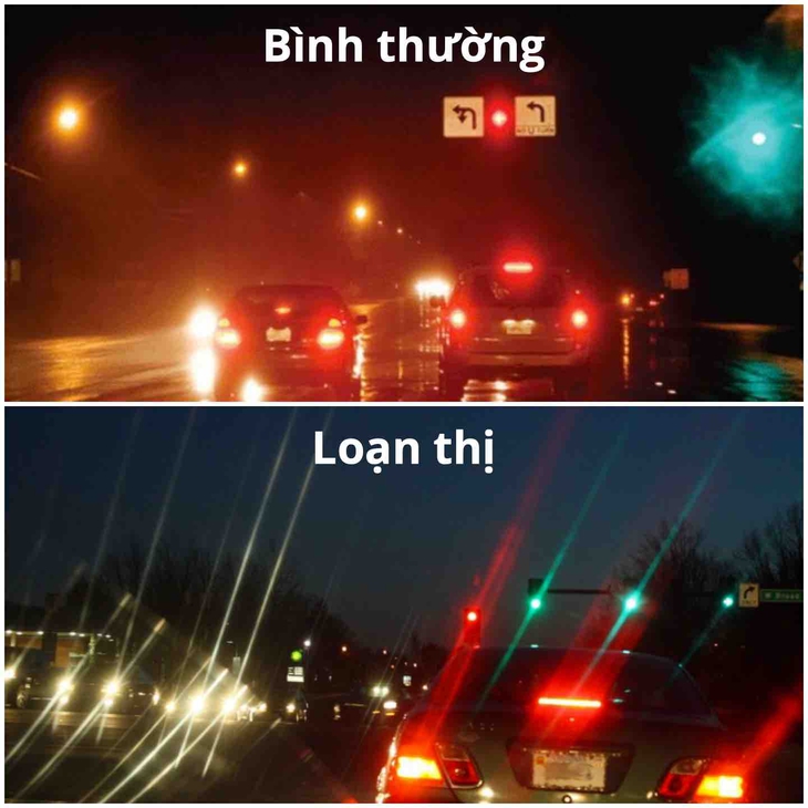 Loạn thị học đường làm thế nào để phòng tránh? - Ảnh 2.