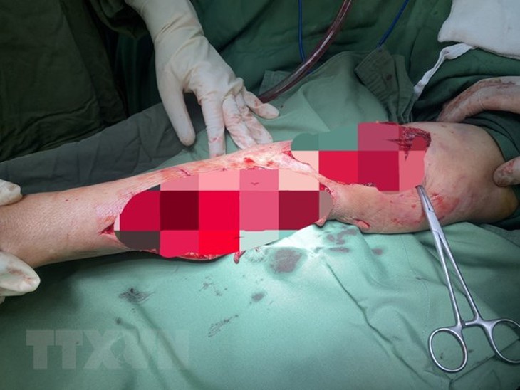 Bà Rịa-Vũng Tàu: Chủ nhà bị chó nuôi của gia đình cắn trọng thương - Ảnh 1.