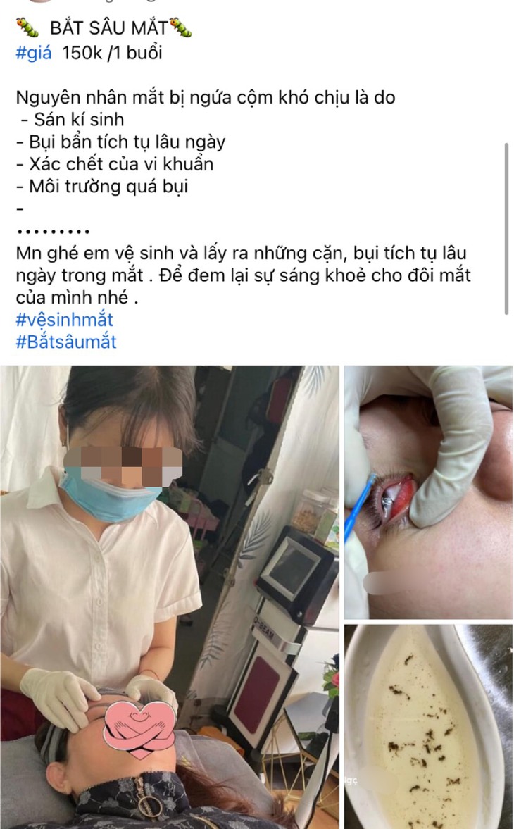 Nở rộ dịch vụ bắt sâu mắt trên mạng xã hội, chuyên gia y tế cảnh báo có nguy cơ hỏng mắt - Ảnh 1. Nở rộ dịch vụ bắt sâu mắt trên mạng xã hội, chuyên gia y tế cảnh báo có nguy cơ hỏng mắt - Ảnh 1.