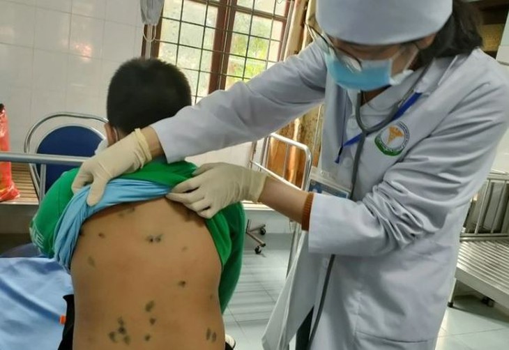 Bác sĩ khám và điều trị cho các học sinh mắc bệnh thuỷ đậu (ảnh Trung tâm Y tế TP. Bắc Kạn) Bác sĩ khám và điều trị cho các học sinh mắc bệnh thuỷ đậu (ảnh Trung tâm Y tế TP. Bắc Kạn)