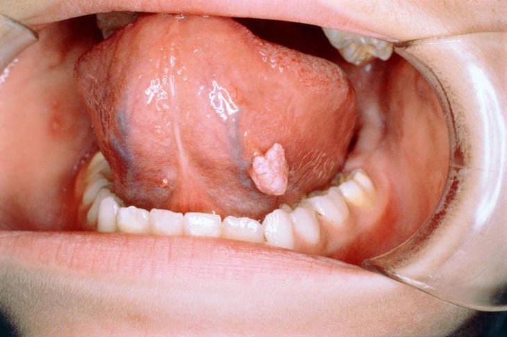 Bệnh lây qua đường tình dục có chữa được không? - Ảnh 2.