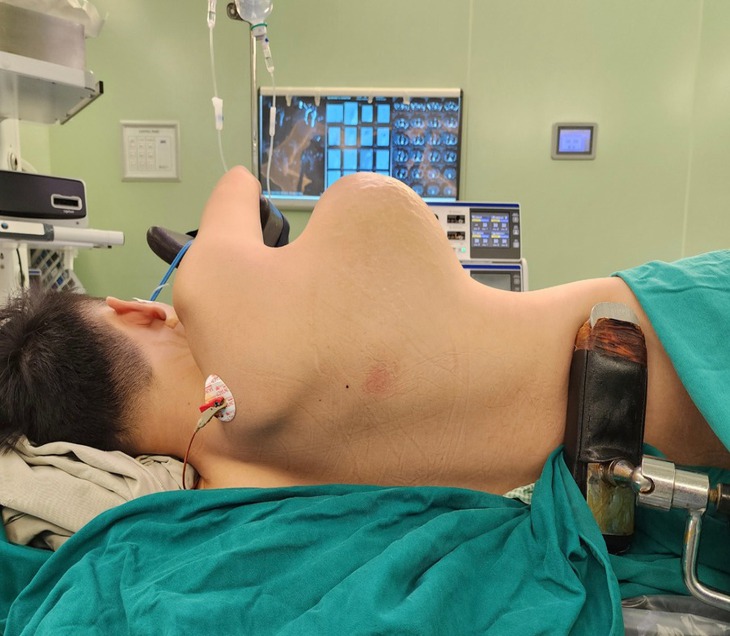 Cậu bé 16 tuổi mang khối u ngực hiếm gặp - Ảnh 1.