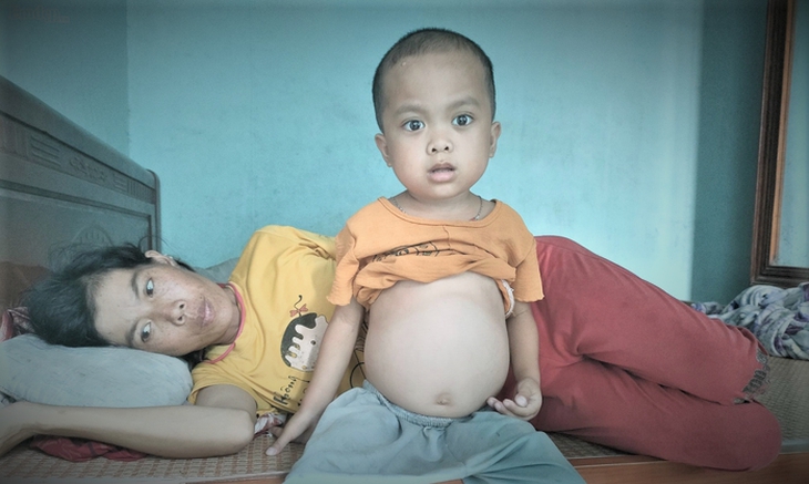 Hai mẹ con cùng mắc trọng bệnh, không có tiền cứu chữa được bạn đọc quan tâm, ủng hộ - Ảnh 2.