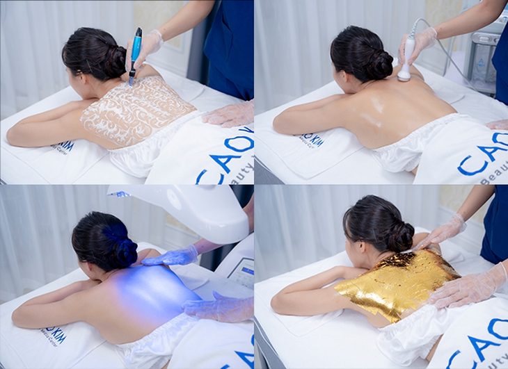 Lời khuyên về phác đồ trị viêm da, mụn lưng tại phòng khám da liễu hiện nay - Ảnh 2.