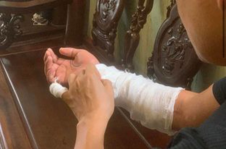 Khởi tố vụ người đàn ông bị chém đứt lìa cánh tay ở Hà Nội - Ảnh 2.