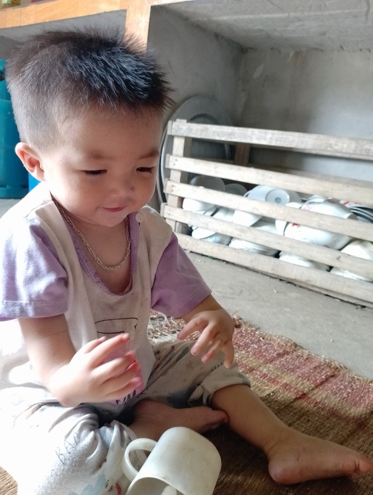 Khuyết tật đôi tay, giờ bé trai dân tộc Dao cần 50 triệu đồng để phẫu thuật tim - Ảnh 1. Khuyết tật đôi tay, giờ bé trai dân tộc Dao cần 50 triệu đồng để phẫu thuật tim - Ảnh 1.