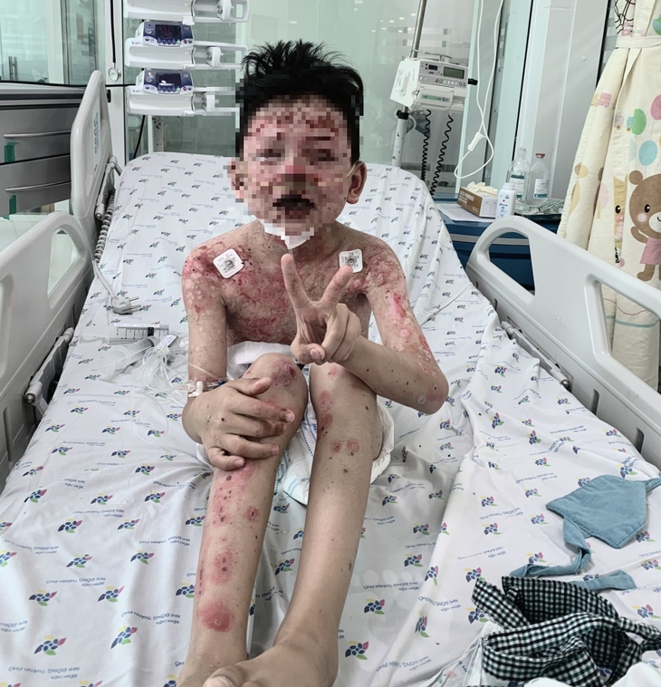 Bé trai nguy kịch sau 2 ngày ăn cua - Ảnh 1.