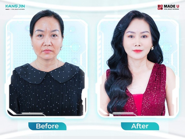 "Tìm lại thanh xuân" miễn phí cho phụ nữ Việt - Ảnh 2. "Tìm lại thanh xuân" miễn phí cho phụ nữ Việt - Ảnh 2.