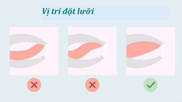 Niềng răng bị hóp má: Chuyên gia chỉ ra 3 nguyên nhân chính và 2 cách khắc phục đơn giản, hiệu quả - Ảnh 2.