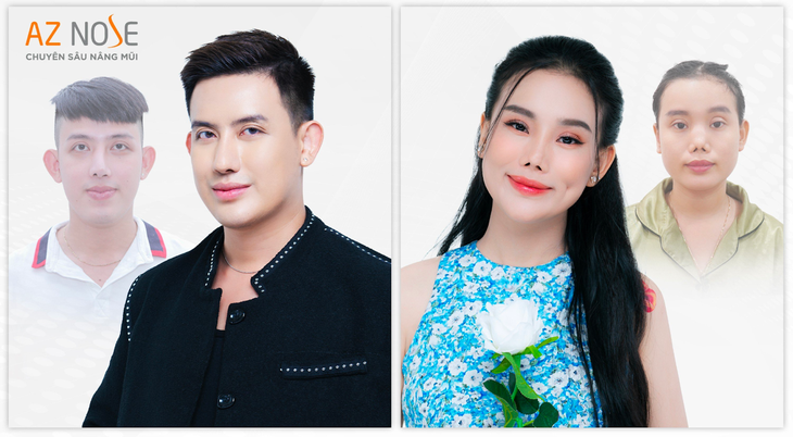 AZ NOSE tài trợ 100% 5 ca tái tạo mũi hỏng - Ảnh 1.