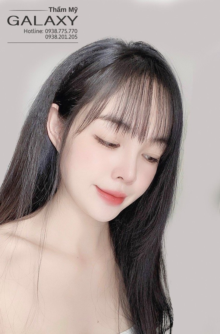 Nâng mũi chuẩn đẹp tự nhiên nhiều người chọn - Ảnh 2.