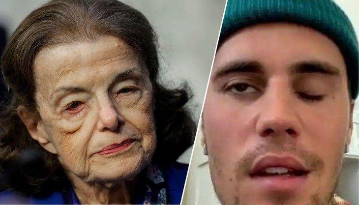 Hội chứng Ramsay Hunt mà ca sĩ Justin Bieber và Thượng nghị sỹ Mỹ Dianne Feinstein gặp phải nguy hiểm thế nào? - Ảnh 3.